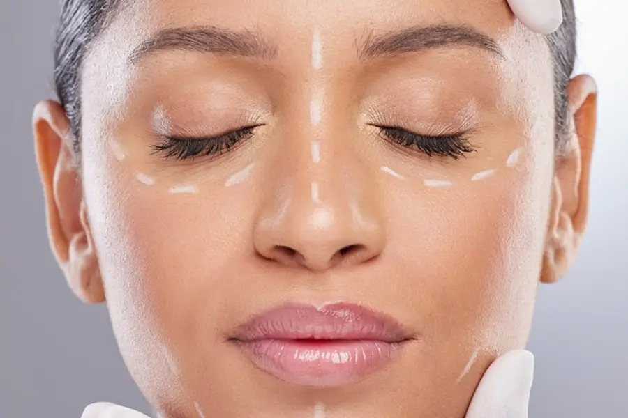 marked for Dermal Filler