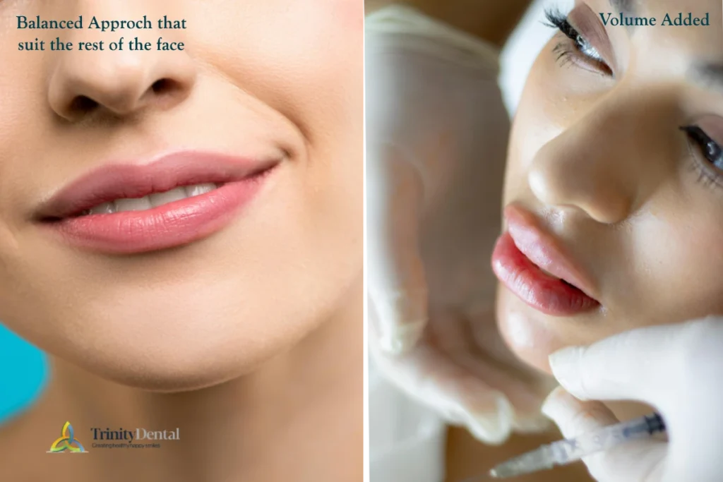 Lip Filling outcomes
