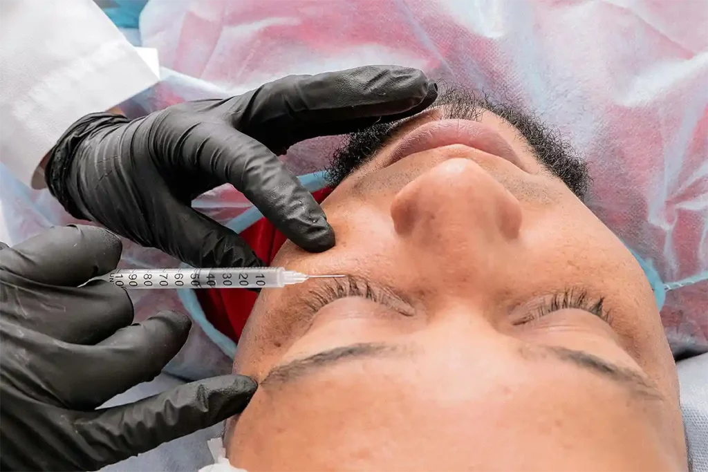 Under Eye Filler treatment