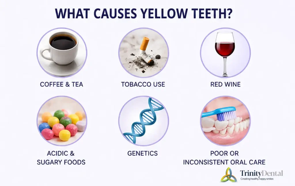 Illustration of common causes of yellow teeth including coffee, smoking, poor oral hygiene, and food stains on enamel